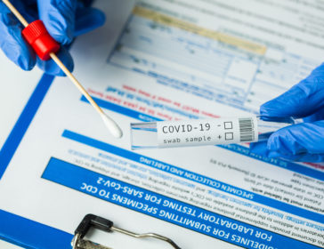 Where To Get Your Covid-19 Tests In Hong Kong?  – PCR Tests, Same-Day Tests, Affordable, And More